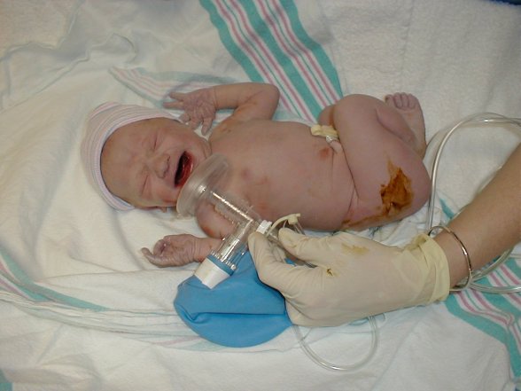 Annabelle in the delivery room.